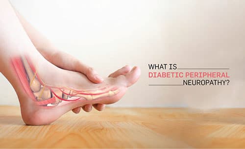 Diabetic peripheral neuropathy